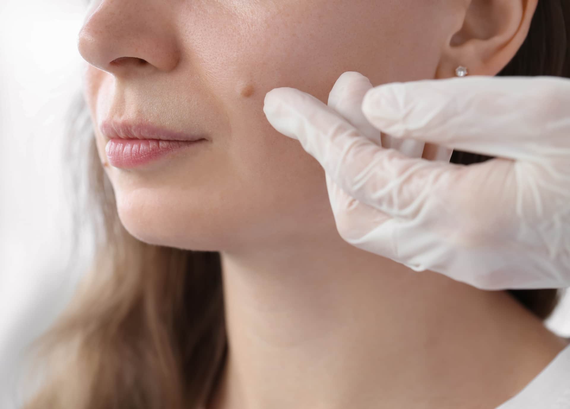 Chirurgie dermatologique à Paris | Chirurgie dematologique | Dr Taveau